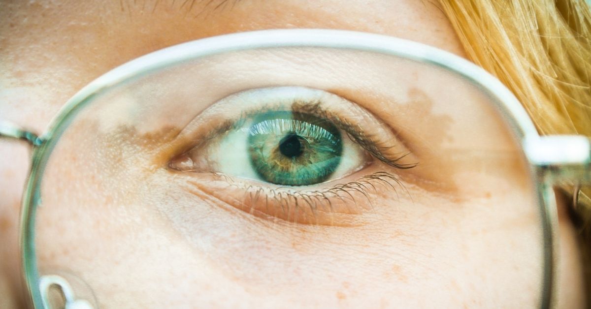 How to Weld Eyeglass Frames